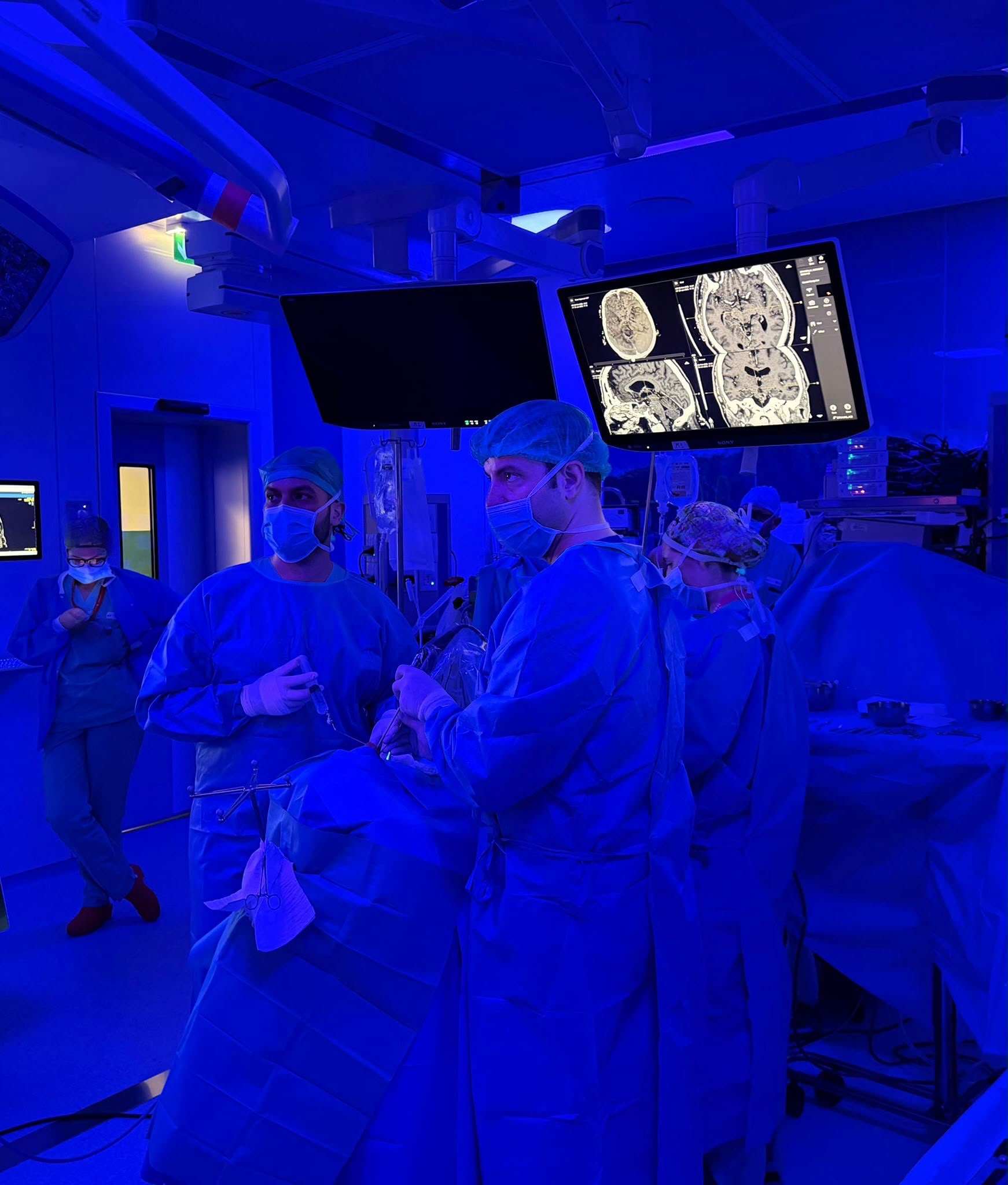 Sala operatoria con monitor di neuronavigazione